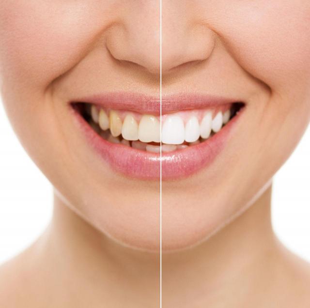 3 powody dla których Twoje zęby żółkną - lepiej to wyeliminuj!