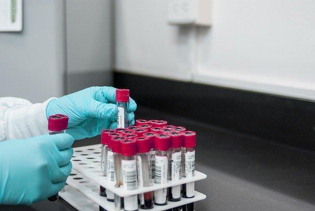 Podstawowe badania laboratoryjne to klucz do zdrowia